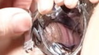 japanese URETHRA ILLUSTRATIONS2.mp4